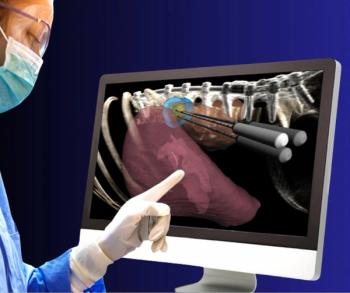 FDA Expands Clearance of Ultrasound-Based Software for Percutaneous Soft Tissue Ablation in the Kidney