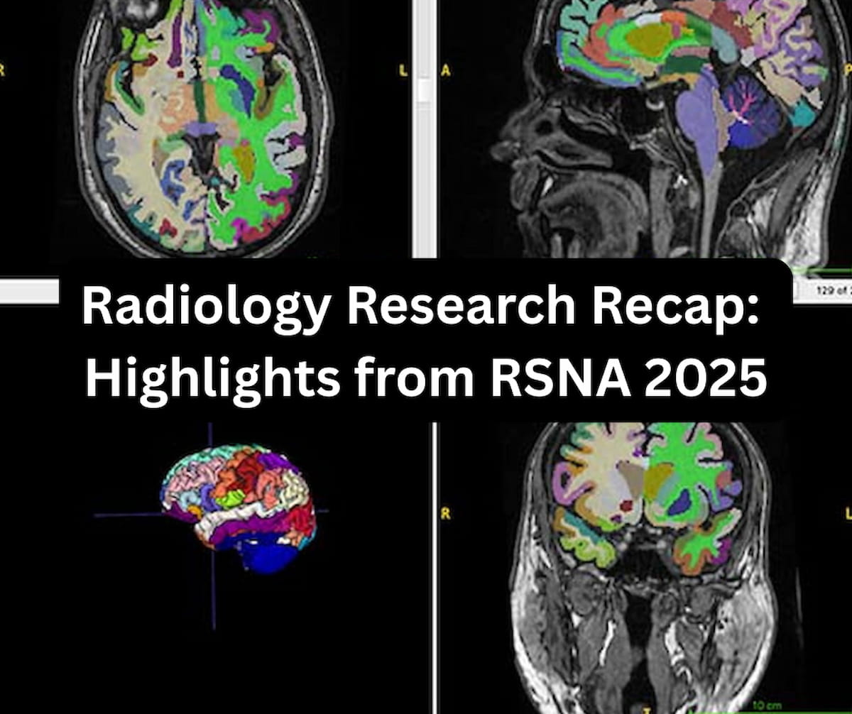 Radiology Research Recap: Highlights from RSNA 2025 | Diagnostic Imaging