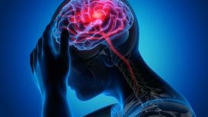 AI-Powered Multi-Phase CTA Pinpoints Brain Blockage Behind Strokes