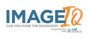 Image IQ Quiz: What's On This Upper GI Series?