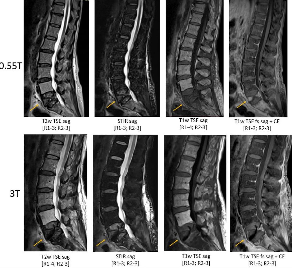 Study Says Low-Field MRI Offers Sufficient Diagnostic Quality for ...