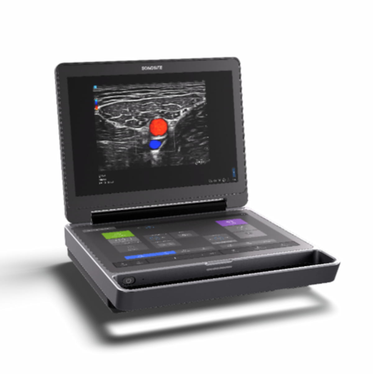 Fujifilm Sonosite Unveils Next-Generation Point-of-Care Ultrasound Device