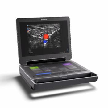 Fujifilm Sonosite Unveils Next-Generation Point-of-Care Ultrasound Device