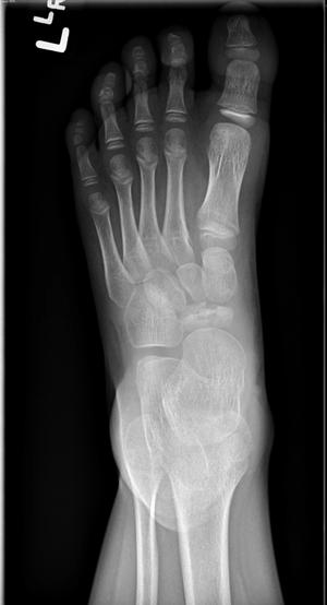 Image IQ Quiz: Pediatric Patient Presents with Foot Finding