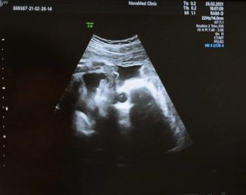 FDA Clears AI-Powered Fetal Ultrasound Analysis Software from DeepEcho