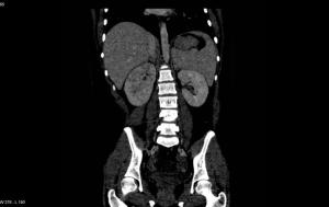 Image IQ Quiz: Patient Presents with Fever and Abdominal Pain