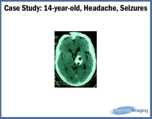 14-year-old, Headache, Seizures