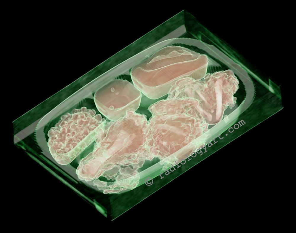 CT scan of a TV dinner.