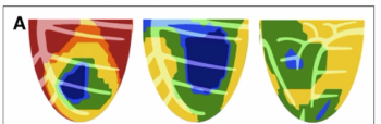 Bracco Diagnostics Unveils Updated HeartSee Software for Cardiac PET Imaging