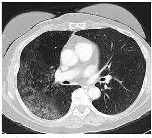 What Radiologists Should Do About Incidental Findings