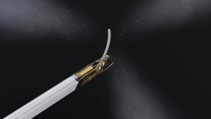 IR Update: FDA Clears Emerging Prostate Tissue Ablation System for Intermediate Risk PCa