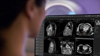 FDA Clears AI-Enabled SmartHeart Cardiac MRI Software