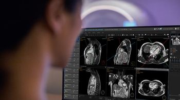 FDA Clears AI-Enabled SmartHeart Cardiac MRI Software