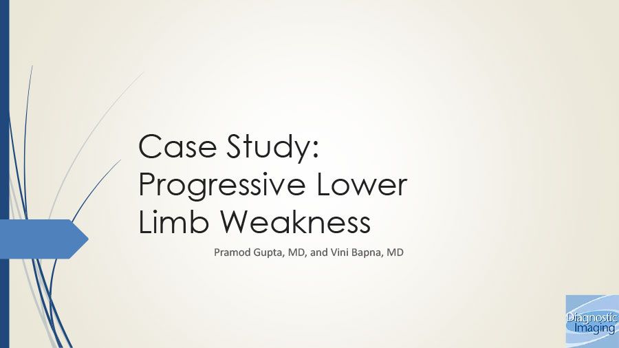 progressive-lower-limb-weakness