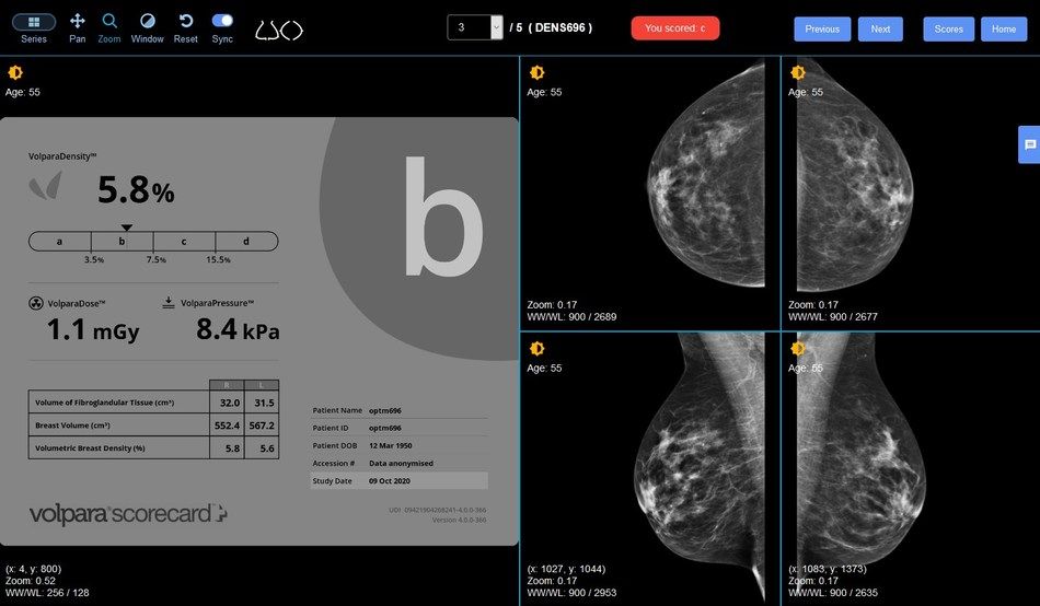 DensityED Screenshot Courtesy: Volpara Health