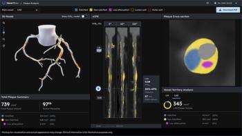 FDA Clears Heartflow’s Next-Generation Plaque Analysis Software for CCTA