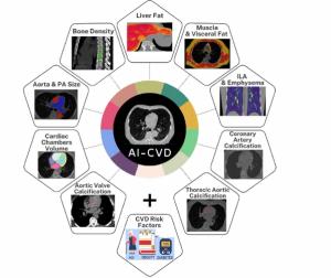 FDA Clears AI Software for Opportunistic Multisystem Computed Tomography Screening