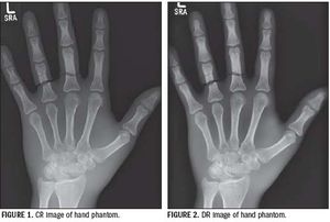 CR and DR triumph over conventional techniques