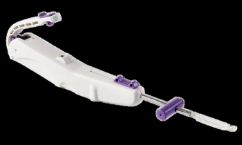 Multicenter Study Cites Benefits of Ultrasound-Guided Carpal Tunnel Release