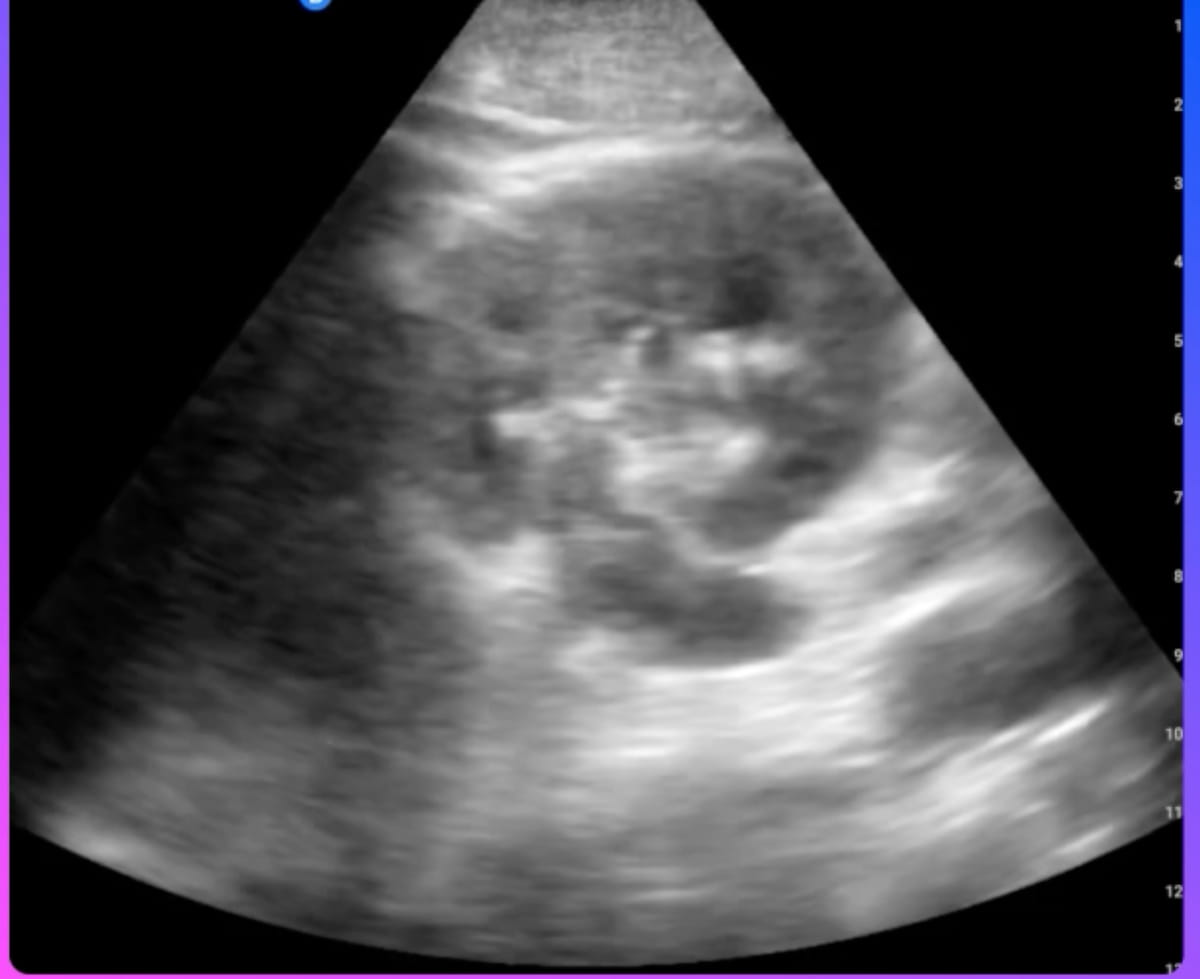 Can a New AI-Powered Point-Of-Care Ultrasound Platform Enhance Reporting Efficiency and Compliance?