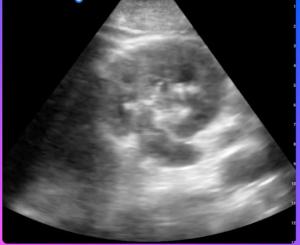 Can a New AI-Powered Point-Of-Care Ultrasound Platform Enhance Reporting Efficiency and Compliance?