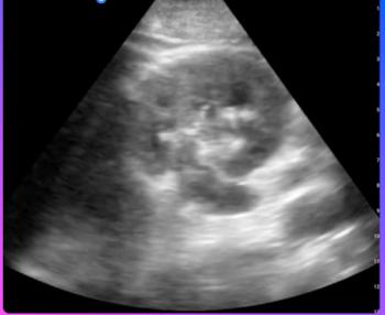 Can a New AI-Powered Point-Of-Care Ultrasound Platform Enhance Reporting Efficiency and Compliance?