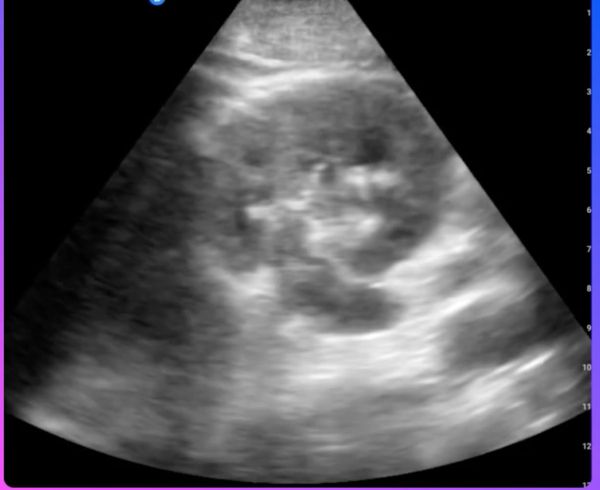 Can a New AI-Powered Point-Of-Care Ultrasound Platform Enhance Reporting Efficiency and Compliance?
