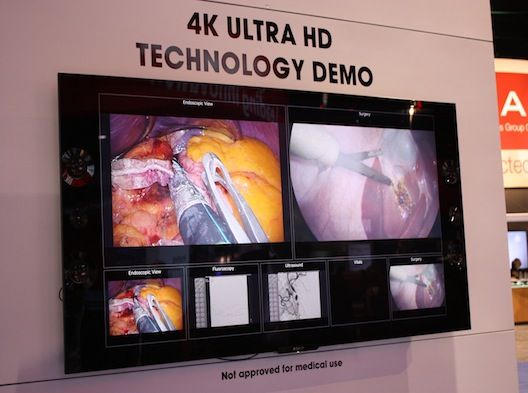Sony's 4K Ultra HD TV
