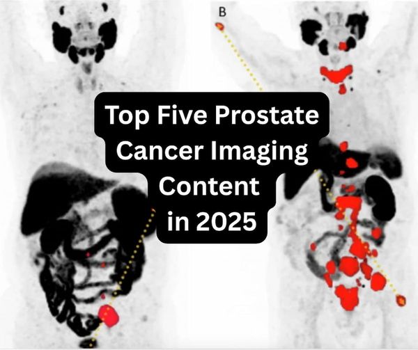 Top Five Prostate Cancer Imaging Content in 2025