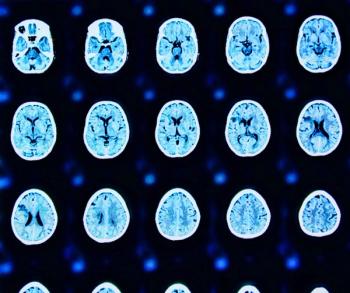 FDA Issues Breakthrough Device Designation for AI-Powered Multi-Triage System for Computed Tomography