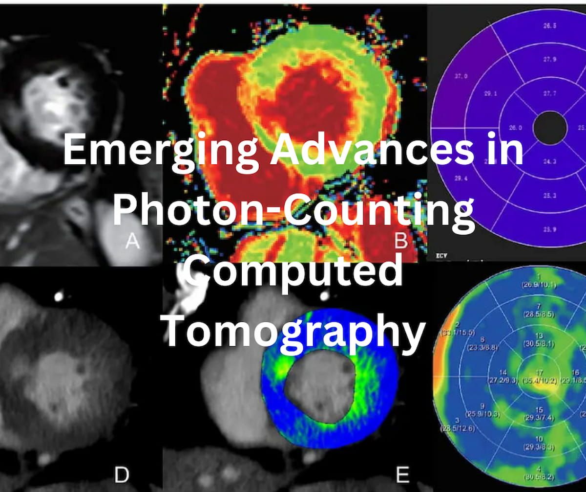 Emerging Advances in Photon-Counting Computed Tomography