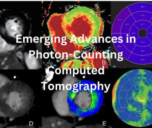 Emerging Advances in Photon-Counting Computed Tomography