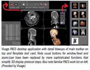 2D PACS has had its day in the sun, now 3D PACS is moving in