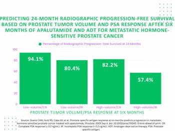 Study Emphasizes PSA and PSMA PET Tumor Volume Assessment for Predicting mHSPC Progression After Apalutamide and ADT