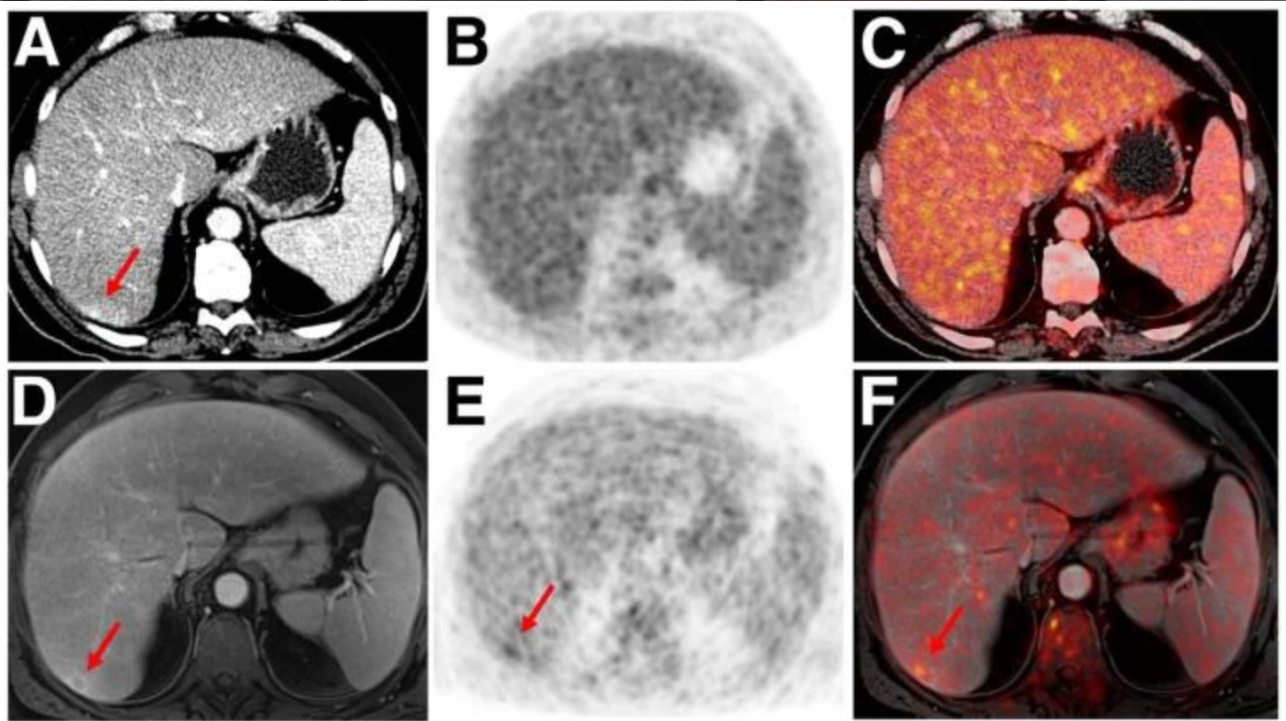 The Top 5 Of Mri In The Top 5 Of Mri In