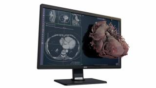 FDA Clears Glasses-Free 3D Software for CT and MRI Assessment