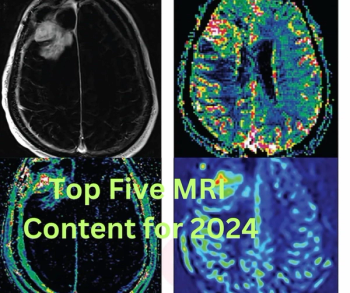Top Five MRI Content of 2024