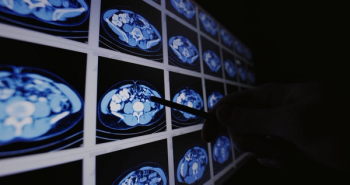 Study Finds Non-Contrast CT 30 Percent Less Accurate than CECT for Abdominal Pain in the ER