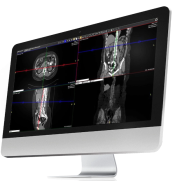 Konica Minolta Unveils New PACS/RIS Platform for Radiologists