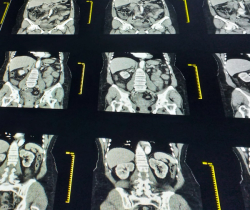 Is CT Imaging Overutilized in the ER?