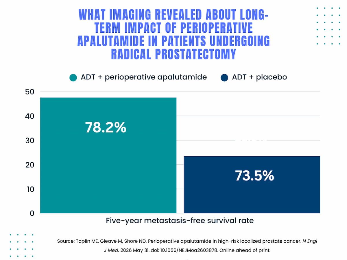 PSMA PET Plays Key Role in Multinational Phase 3 Trial of Perioperative Apalutamide for PCa