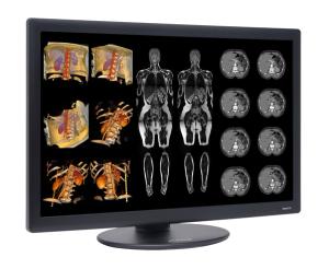 FDA Clearance Given for 6 MP LED Widescreen Radiology Display