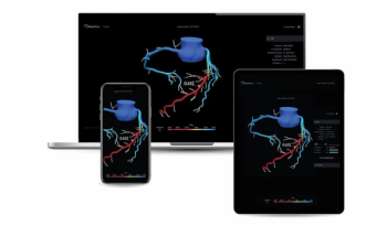HeartFlow Gets New CPT Reimbursement Code for CT-Based Fraction Flow Reserve Analysis