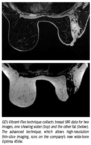 GE matches MR technology to developing clinical need