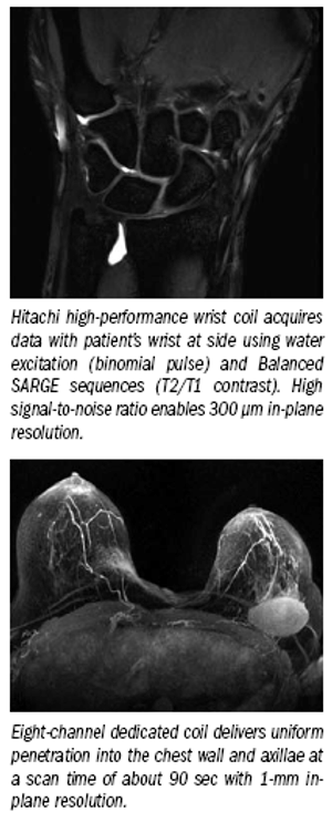 Novel designs distinguish Hitachi's MRI scanners