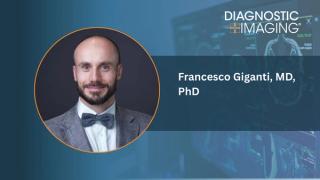 Can MRI-Based AI Have an Impact in Reducing Unnecessary Prostate Biopsies?