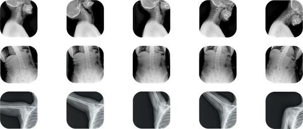 FDA Grants 510(k) Clearance To Chiropractic Straight Arm Radiography System