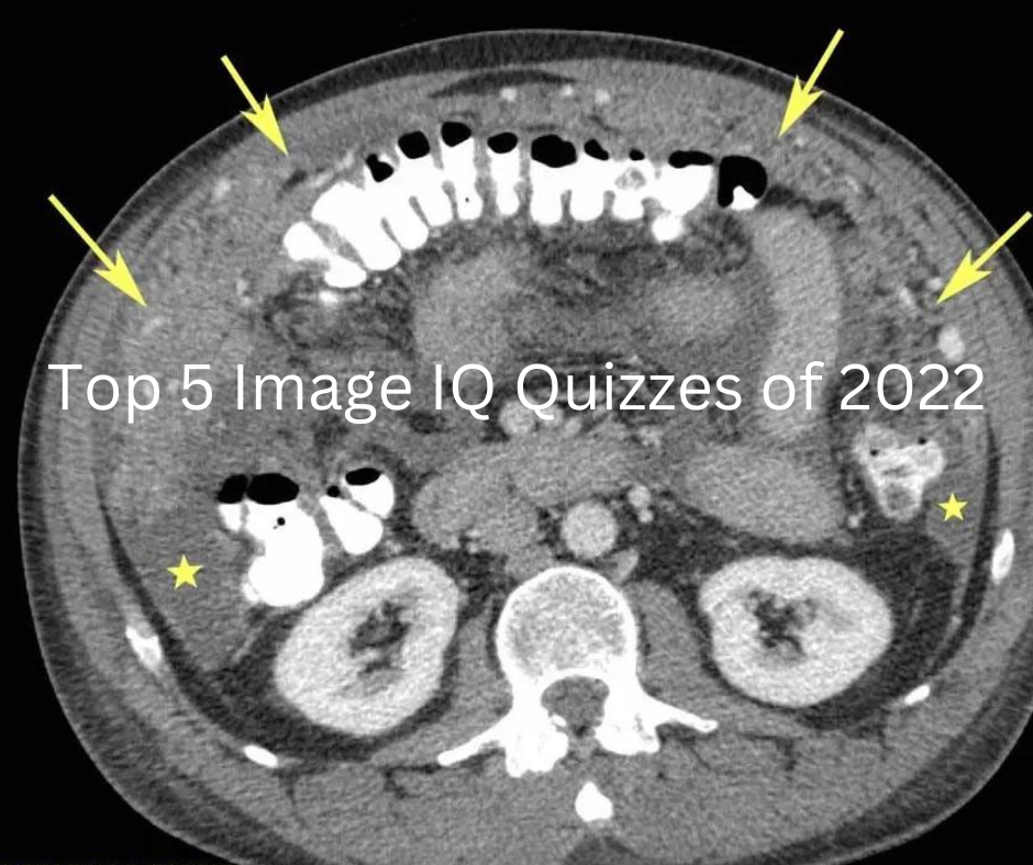 Diagnostic Imaging's Top 5 Image IQ Quizzes of 2022