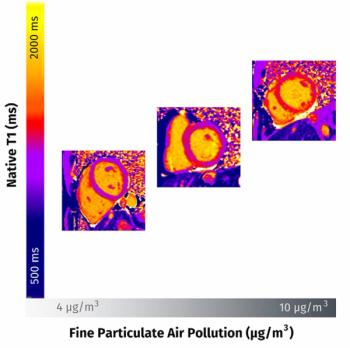 Cardiac MRI Study Affirms Link Between Air Pollution Exposure and Increased Diffuse Myocardial Fibrosis 