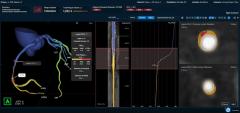 FDA Clears AI-Enabled FFR-IQ Software for Estimating Fractional Flow Reserve from CCTA